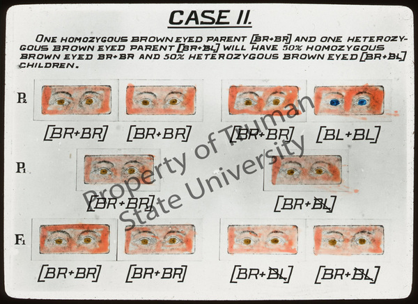 Case_II_Eyes-wm.jpg