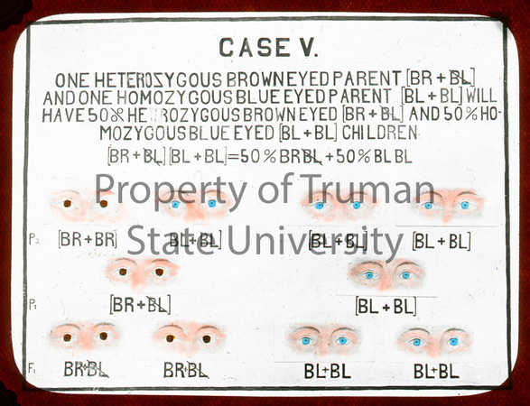 Case-V-Eyes-wm1.jpg