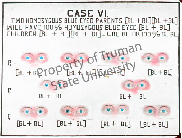 Case-VI-Eyes-wm.jpg